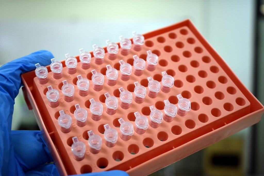 Xét nghiệm HPV (Human Papillomavirus)
